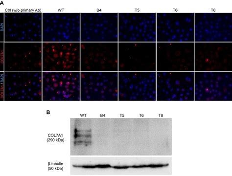 Pathogenic Mechanisms of Collagen TypeⅦA1 (COL7A1) 